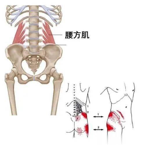 🗣右侧腰方肌疼痛是怎么回事？