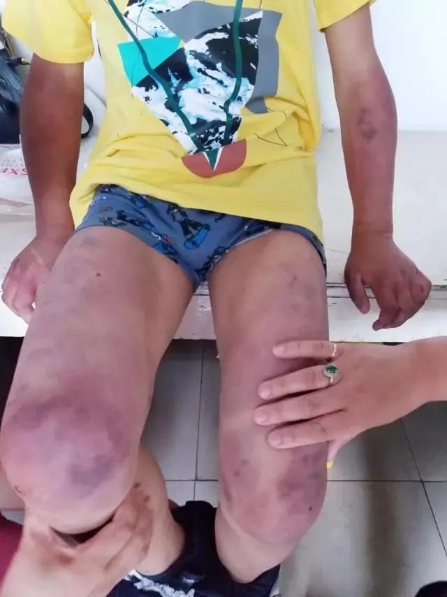 一个受到家庭暴力孩子的控诉

家庭是每一个人最温暖的避风港，但是对于我来说，这个