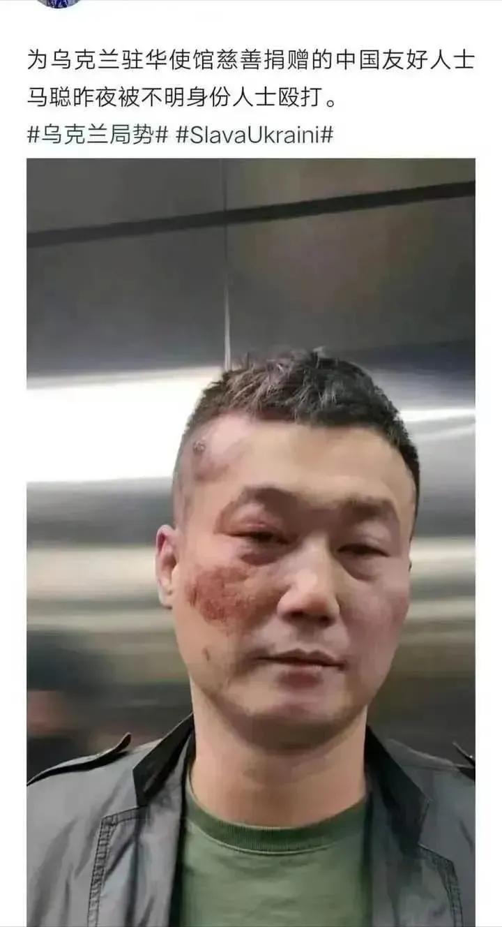 挺俄罗斯，是为了中国人可以不上战场。挺乌，是为了绿卡积分吗？
