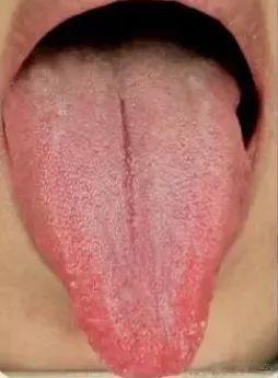 判断肝气郁结？看这里就行！[赞]肝是人体的“化工厂”，承担着人体的解毒功能，此外