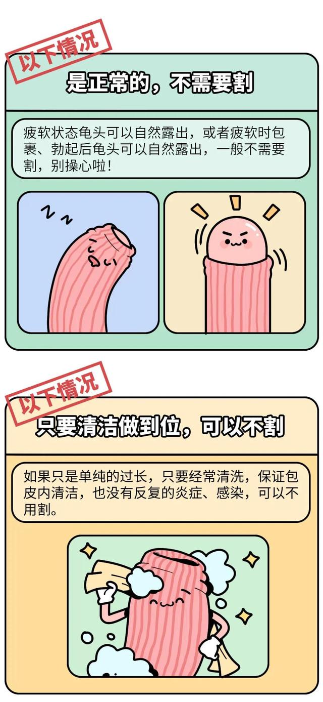 割了包皮以后的男生会变成什么样？
